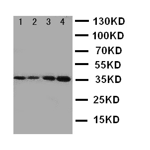 PROC / Protein C Antibody - WB of PROC / Protein C antibody. Lane 1: JURKAT Cell Lysate. Lane 2: CEM Cell Lysate. Lane 3: SMMC Cell Lysate. Lane 4: HELA Cell Lysate.