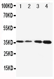 PROC / Protein C Antibody - Western blot analysis of Protein C using anti-Protein C antibody. Electrophoresis was performed on a 5-20% SDS-PAGE gel at 70V (Stacking gel) / 90V (Resolving gel) for 2-3 hours. The sample well of each lane was loaded with 50ug of sample under reducing conditions. Lane 1: JURKAT Cell Lysate Lane 2: CEM Cell Lysate Lane 3: SMMC Cell Lysate Lane 4: HELA Cell Lysate. After Electrophoresis, proteins were transferred to a Nitrocellulose membrane at 150mA for 50-90 minutes. Blocked the membrane with 5% Non-fat Milk/ TBS for 1.5 hour at RT. The membrane was incubated with rabbit anti-Protein C antigen affinity purified polyclonal antibody at 0.5 µg/mL overnight at 4°C, then washed with TBS-0.1% Tween 3 times with 5 minutes each and probed with a goat anti-rabbit IgG-HRP secondary antibody at a dilution of 1:10000 for 1.5 hour at RT. The signal is developed using an Enhanced Chemiluminescent detection (ECL) kit with Tanon 5200 system. A specific band was detected for Protein C at approximately 36KD. The expected band size for Protein C is at 52KD.