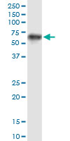 PROC / Protein C Antibody - PROC monoclonal antibody (M01), clone 3A10. Western Blot analysis of PROC expression in human liver.