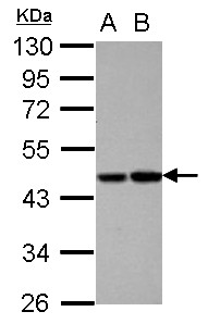 PROC / Protein C Antibody - Sample (30 ug of whole cell lysate) A: HepG2 B: HCT116 10% SDS PAGE PROC / Protein C antibody diluted at 1:1000
