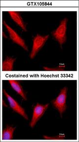 PROC / Protein C Antibody - Immunofluorescence of methanol-fixed HeLa, using Protein C antibody at 1:500 dilution.