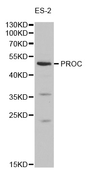 PROC / Protein C Antibody - Western blot analysis of extracts of ES-2 cells, using PROC antibody at 1:1000 dilution. The secondary antibody used was an HRP Goat Anti-Rabbit IgG (H+L) at 1:10000 dilution. Lysates were loaded 25ug per lane and 3% nonfat dry milk in TBST was used for blocking.