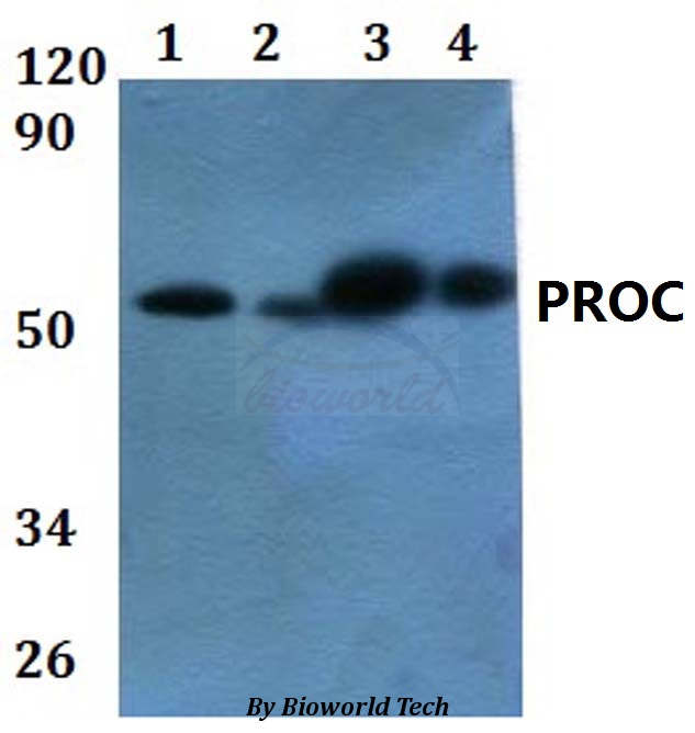 PROC / Protein C Antibody - Western blot of PROC antibody at 1:500 dilution. Lane 1: HEK293T whole cell lysate. Lane 2: Raw264.7 whole cell lysate. Lane 3: H9C2 whole cell lysate. Lane 4: HELA whole cell lysate.