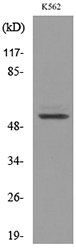 PROC / Protein C Antibody - Western blot analysis of lysate from K562 cells, using PROC Antibody.