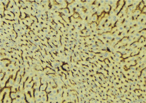 PROC / Protein C Antibody - 1:100 staining mouse liver tissue by IHC-P. The sample was formaldehyde fixed and a heat mediated antigen retrieval step in citrate buffer was performed. The sample was then blocked and incubated with the antibody for 1.5 hours at 22°C. An HRP conjugated goat anti-rabbit antibody was used as the secondary.