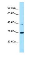 PROCA1 Antibody - PROCA1 antibody Western Blot of ACHN.  This image was taken for the unconjugated form of this product. Other forms have not been tested.