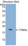 Procalcitonin Antibody - Western blot of recombinant CGRP / Calcitonin.  This image was taken for the unconjugated form of this product. Other forms have not been tested.