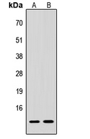 Procalcitonin Antibody - Western blot analysis of Procalcitonin expression in HeLa (A); H9C2 (B) whole cell lysates.