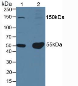 Procollagen I N-Terminal Propeptide Antibody