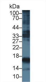 Procollagen III N-Terminal Propeptide Antibody