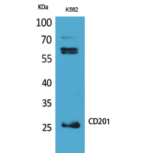 PROCR / EPCR Antibody - Western blot of CD201 antibody