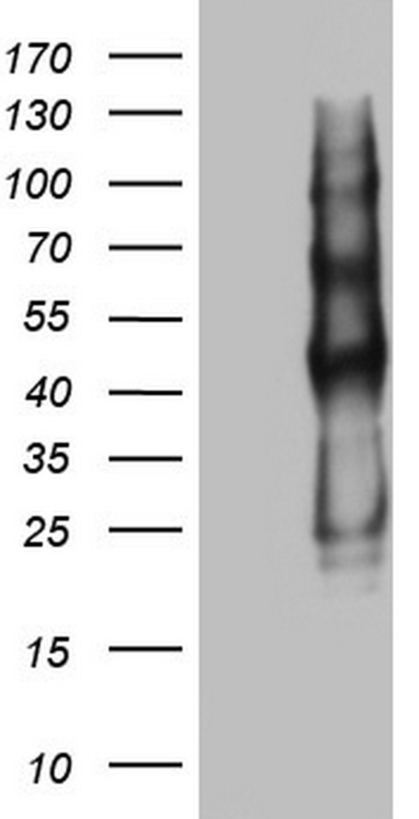 PROCR / EPCR Antibody - HEK293T cells were transfected with the pCMV6-ENTRY control. (Left lane) or pCMV6-ENTRY PROCR. (Right lane) cDNA for 48 hrs and lysed. Equivalent amounts of cell lysates. (5 ug per lane) were separated by SDS-PAGE and immunoblotted with anti-PROCR.
