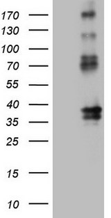 PROCR / EPCR Antibody - HEK293T cells were transfected with the pCMV6-ENTRY control. (Left lane) or pCMV6-ENTRY PROCR. (Right lane) cDNA for 48 hrs and lysed. Equivalent amounts of cell lysates. (5 ug per lane) were separated by SDS-PAGE and immunoblotted with anti-PROCR. (1:2000)