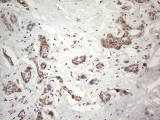 PROCR / EPCR Antibody - Immunohistochemical staining of paraffin-embedded Human breast tissue within the normal limits using anti-PROCR mouse monoclonal antibody. (Heat-induced epitope retrieval by 1mM EDTA in 10mM Tris buffer. (pH8.5) at 120°C for 3 min. (1:150)