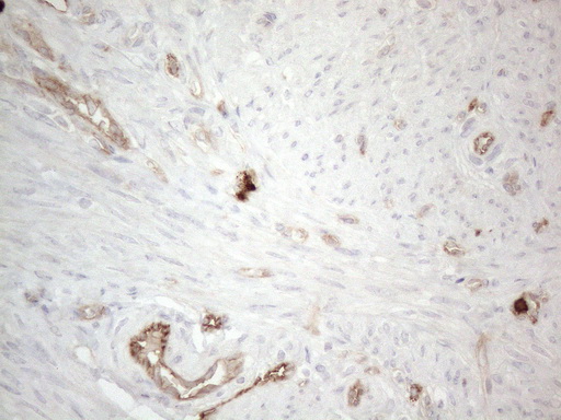 PROCR / EPCR Antibody - Immunohistochemical staining of paraffin-embedded Human endometrium tissue within the normal limits using anti-PROCR mouse monoclonal antibody. (Heat-induced epitope retrieval by 1mM EDTA in 10mM Tris buffer. (pH8.5) at 120°C for 3 min. (1:150)