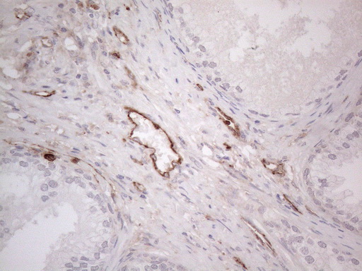 PROCR / EPCR Antibody - Immunohistochemical staining of paraffin-embedded Human prostate tissue within the normal limits using anti-PROCR mouse monoclonal antibody. (Heat-induced epitope retrieval by 1mM EDTA in 10mM Tris buffer. (pH8.5) at 120°C for 3 min. (1:150)
