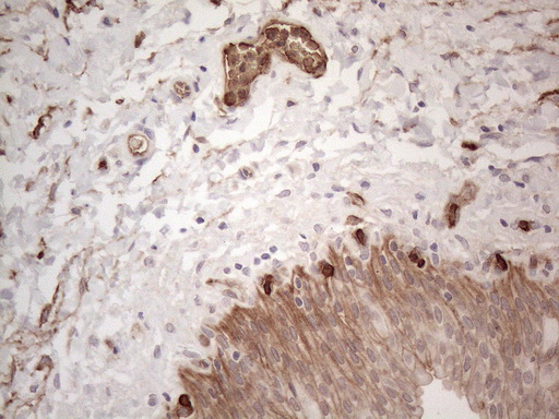 PROCR / EPCR Antibody - Immunohistochemical staining of paraffin-embedded Human bladder tissue within the normal limits using anti-PROCR mouse monoclonal antibody. (Heat-induced epitope retrieval by 1mM EDTA in 10mM Tris buffer. (pH8.5) at 120°C for 3 min. (1:150)