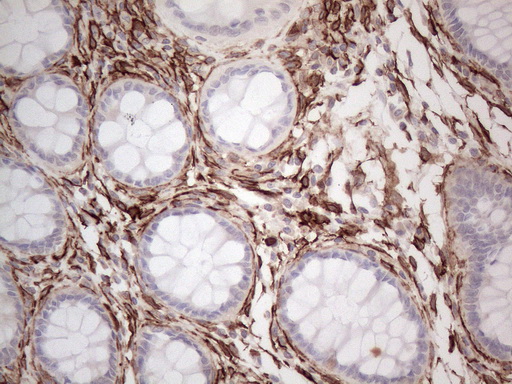 PROCR / EPCR Antibody - Immunohistochemical staining of paraffin-embedded Human colon tissue within the normal limits using anti-PROCR mouse monoclonal antibody. (Heat-induced epitope retrieval by 1mM EDTA in 10mM Tris buffer. (pH8.5) at 120°C for 3 min. (1:150)