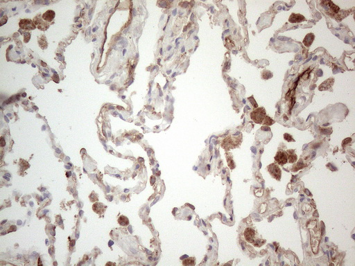 PROCR / EPCR Antibody - Immunohistochemical staining of paraffin-embedded Human lung tissue within the normal limits using anti-PROCR mouse monoclonal antibody. (Heat-induced epitope retrieval by 1mM EDTA in 10mM Tris buffer. (pH8.5) at 120°C for 3 min. (1:150)