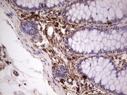 PROCR / EPCR Antibody - IHC of paraffin-embedded Human colon tissue using anti-PROCR mouse monoclonal antibody. (Heat-induced epitope retrieval by 1 mM EDTA in 10mM Tris, pH8.5, 120°C for 3min).