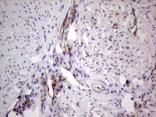 PROCR / EPCR Antibody - IHC of paraffin-embedded Human endometrium tissue using anti-PROCR mouse monoclonal antibody. (Heat-induced epitope retrieval by 1 mM EDTA in 10mM Tris, pH8.5, 120°C for 3min).
