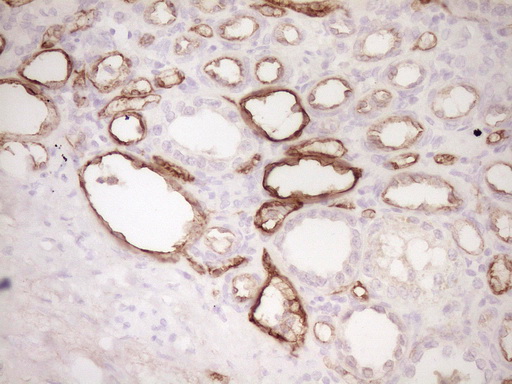 PROCR / EPCR Antibody - Immunohistochemical staining of paraffin-embedded Human Kidney tissue within the normal limits using anti-PROCR mouse monoclonal antibody. (Heat-induced epitope retrieval by 1 mM EDTA in 10mM Tris, pH8.5, 120C for 3min,