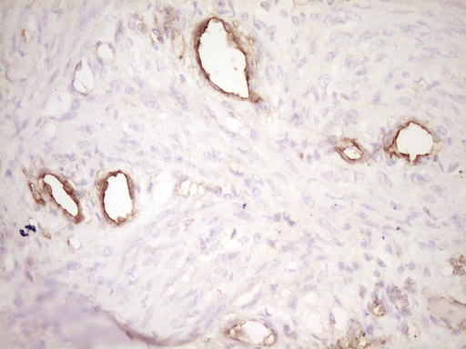 PROCR / EPCR Antibody - IHC of paraffin-embedded Human endometrium tissue using anti-PROCR mouse monoclonal antibody. (Heat-induced epitope retrieval by 1 mM EDTA in 10mM Tris, pH8.5, 120°C for 3min).