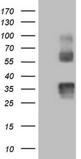 PROCR / EPCR Antibody - HEK293T cells were transfected with the pCMV6-ENTRY control (Left lane) or pCMV6-ENTRY PROCR (Right lane) cDNA for 48 hrs and lysed. Equivalent amounts of cell lysates (5 ug per lane) were separated by SDS-PAGE and immunoblotted with anti-PROCR.
