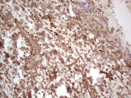 PROCR / EPCR Antibody - IHC of paraffin-embedded Human tonsil using anti-PROCR mouse monoclonal antibody. (Heat-induced epitope retrieval by 1 mM EDTA in 10mM Tris, pH8.5, 120°C for 3min).