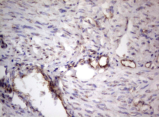 PROCR / EPCR Antibody - IHC of paraffin-embedded Human endometrium tissue using anti-PROCR Mouse monoclonal antibody. (heat-induced epitope retrieval by 1 mM EDTA in 10mM Tris, pH8.5, 120°C for 3min).