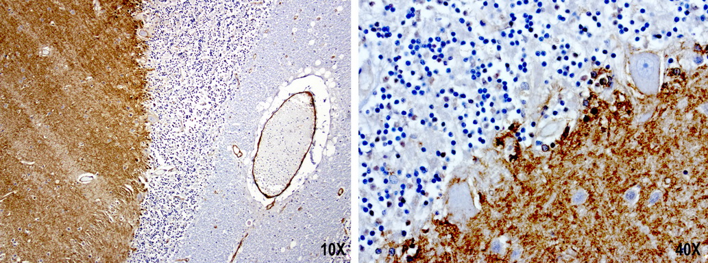 PROCR / EPCR Antibody - Immunohistochemical staining of paraffin-embedded human brain using anti-PROCR clone UMAB200 mouse monoclonal antibody  at 1:100 with Polink2 Broad HRP DAB detection kit; heat-induced epitope retrieval with GBI citrate pH6.0 HIER buffer using pressure chamber for 3 minutes at 110C. Very strong cytoplasmic and membraneous staining in the molecular layer.
