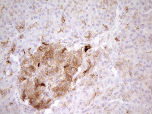 PROCR / EPCR Antibody - Immunohistochemical staining of paraffin-embedded Human pancreas tissue using anti-PROCR mouse monoclonal antibody. (Heat-induced epitope retrieval by 1mM EDTA in 10mM Tris buffer. (pH8.0) at 120C for 3 min. (1:200)