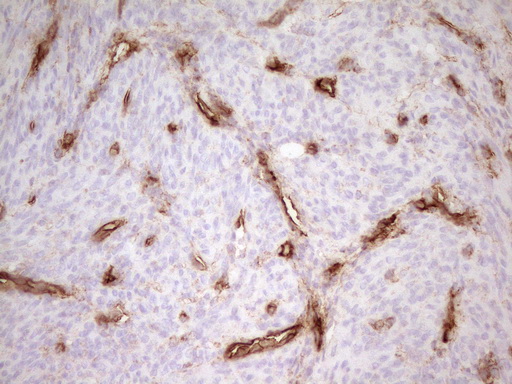 PROCR / EPCR Antibody - Immunohistochemical staining of paraffin-embedded Human endometrium tissue using anti-PROCR mouse monoclonal antibody. (Heat-induced epitope retrieval by 1mM EDTA in 10mM Tris buffer. (pH8.0) at 120C for 3 min. (1:200)