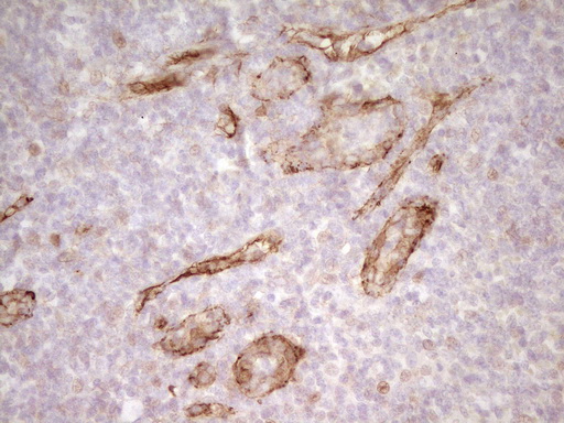 PROCR / EPCR Antibody - Immunohistochemical staining of paraffin-embedded Human tonsil using anti-PROCR mouse monoclonal antibody. (Heat-induced epitope retrieval by 1mM EDTA in 10mM Tris buffer. (pH8.0) at 120C for 3 min. (1:200)