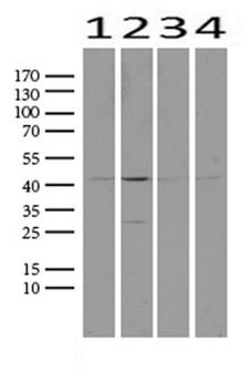 PROCR / EPCR Antibody - Western blot analysis of extracts. (25ug) from 4 different cell lines by using anti-PROCR monoclonal antibody. (1:500). (1: HEK293; 2: Hela; 3: MCF7; 4: HepG2) Dilution: 1:500
