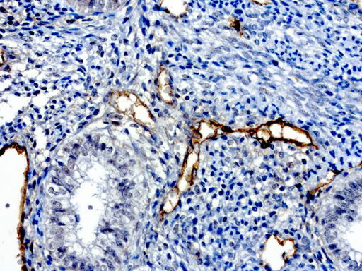 PROCR / EPCR Antibody - Immunohistochemical staining of paraffin-embedded human normal adjacent endometrium using anti-PROCR clone UMAB200 mouse monoclonal antibody  at 1:100 with Polink2 Broad HRP DAB detection kit; heat-induced epitope retrieval with GBI citrate pH6.0 HIER buffer using pressure chamber for 3 minutes at 110C. Cytoplasmic staining is very strong in the vascular endothelia cells and weak nuclear and cytoplasmic staining in in the glandular endometrial cells.