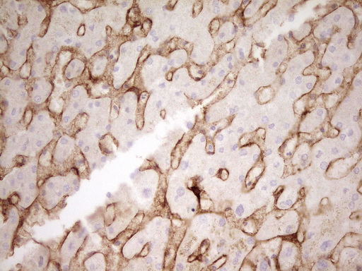 PROCR / EPCR Antibody - Immunohistochemical staining of paraffin-embedded Human liver tissue using anti-PROCR mouse monoclonal antibody. (Heat-induced epitope retrieval by 1mM EDTA in 10mM Tris buffer. (pH8.0) at 120C for 3 min. (1:200)