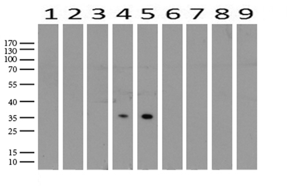 PROCR / EPCR Antibody - Western blot analysis of extracts. (15ug) from 9 Human tissue by using anti-PROCR monoclonal antibody. (1: Testis; 2: Uterus; 3: Breast; 4: Brain; 5: Liver; 6: Ovary; 7: Thyroid gland; 8: colon:;9:Spleen). (1:500) Dilution: 1:500