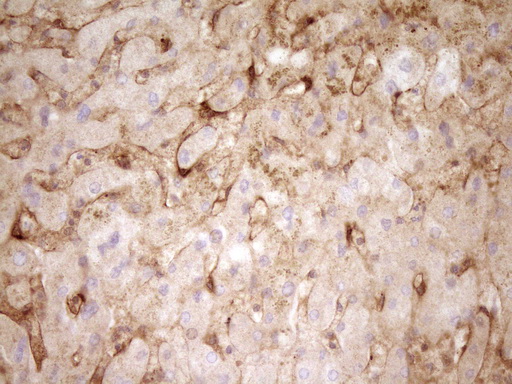 PROCR / EPCR Antibody - Immunohistochemical staining of paraffin-embedded Human liver tissue using anti-PROCR mouse monoclonal antibody. (Heat-induced epitope retrieval by 1mM EDTA in 10mM Tris buffer. (pH8.0) at 120C for 3 min. (1:200)