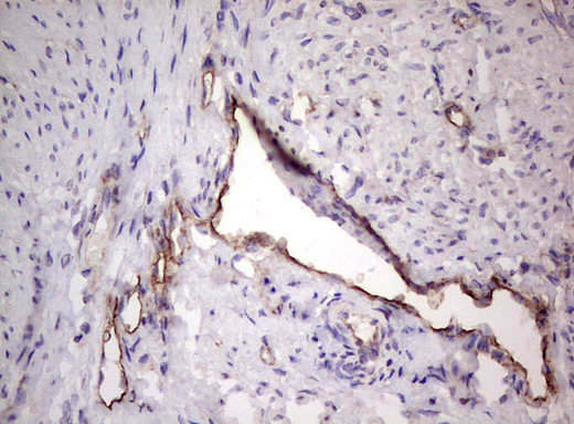 PROCR / EPCR Antibody - Immunohistochemical staining of paraffin-embedded Human endometrium tissue within the normal limits using anti-PROCR Mouse monoclonal antibody.  heat-induced epitope retrieval by 1 mM EDTA in 10mM Tris, pH8.5, 120C for 3min)
