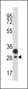 PROCR / EPCR Antibody - Western blot of CD201 antibody in T47D cell line lysates (35 ug/lane). CD201 (arrow) was detected using the purified antibody.