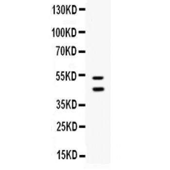 PROCR / EPCR Antibody - Western blot analysis of EPCR/CD201 expression in A549 whole cell lysates (lane 1). EPCR/CD201 at 46 kD, 52 kD was detected using rabbit anti- EPCR/CD201 Antigen Affinity purified polyclonal antibody at 0.5 ug/mL. The blot was developed using chemiluminescence (ECL) method.
