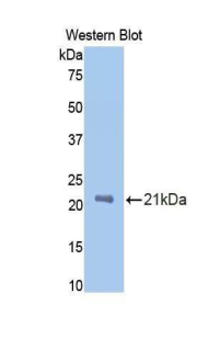 PROCR / EPCR Antibody - Western blot of recombinant PROCR / EPCR.  This image was taken for the unconjugated form of this product. Other forms have not been tested.