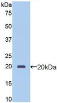 PROCR / EPCR Antibody - Western Blot; Sample: Recombinant PROCR, Human.