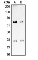 PROCR / EPCR Antibody - Western blot analysis of CD201 expression in HeLa (A); rat brain (B) whole cell lysates.
