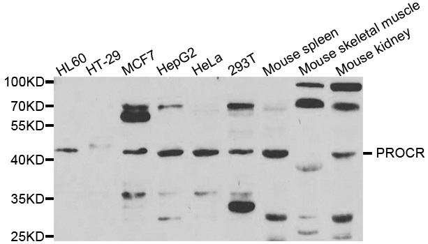 PROCR / EPCR Antibody - Western blot analysis of extracts of various cell lines.