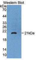 PRODH Antibody - Western blot of PRODH antibody.