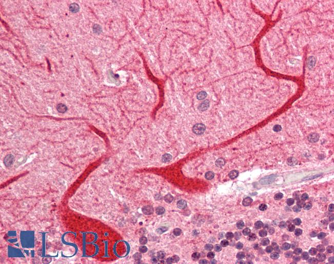 Proenkephalin / PENK Antibody - Human Brain, Cerebellum: Formalin-Fixed, Paraffin-Embedded (FFPE).  This image was taken for the unconjugated form of this product. Other forms have not been tested.