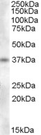 Proenkephalin / PENK Antibody - Antibody (0.3 ug/ml) staining of Human Adrenal Gland lysate (35 ug protein in RIPA buffer). Primary incubation was 1 hour. Detected by chemiluminescence.