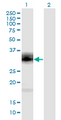 Proenkephalin / PENK Antibody - Western Blot analysis of PENK expression in transfected 293T cell line by PENK monoclonal antibody (M04), clone 9E7.Lane 1: PENK transfected lysate (Predicted MW: 29.48 KDa).Lane 2: Non-transfected lysate.